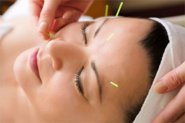 facial acupuncture zahra